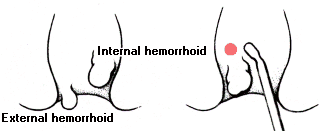 IRC